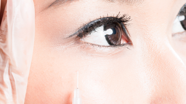 ヒアルロン酸注入